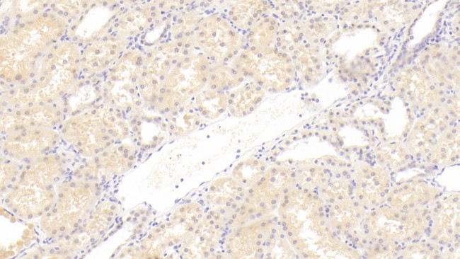 CTRP1 Antibody in Immunohistochemistry (Paraffin) (IHC (P))