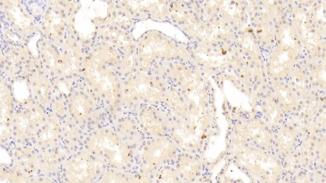 RIP1 Antibody in Immunohistochemistry (Paraffin) (IHC (P))