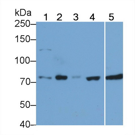 RIP1 Antibody in Western Blot (WB)