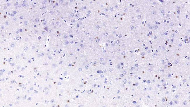 PCSK9 Antibody in Immunohistochemistry (Paraffin) (IHC (P))