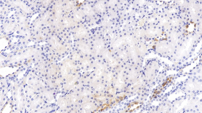 PCSK9 Antibody in Immunohistochemistry (Paraffin) (IHC (P))