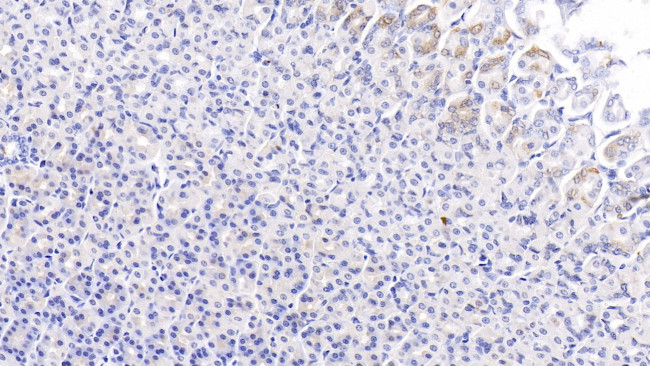 PCSK9 Antibody in Immunohistochemistry (Paraffin) (IHC (P))