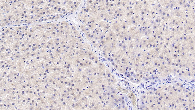 HPD Antibody in Immunohistochemistry (Paraffin) (IHC (P))