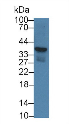 CRHBP Antibody in Western Blot (WB)