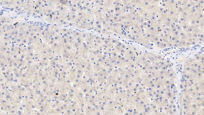 SAA Antibody in Immunohistochemistry (Paraffin) (IHC (P))