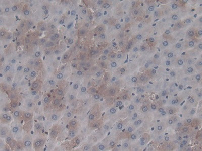 Prothrombin Antibody in Immunohistochemistry (Paraffin) (IHC (P))