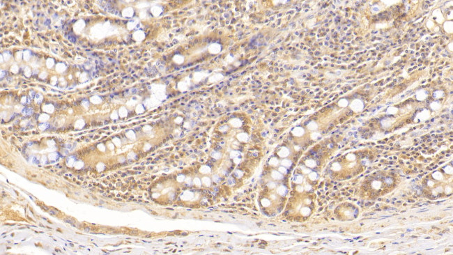 Complement C5a Antibody in Immunohistochemistry (Paraffin) (IHC (P))