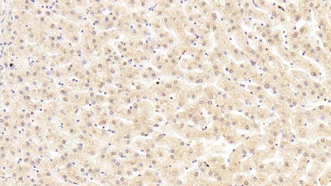 Complement C5a Antibody in Immunohistochemistry (Paraffin) (IHC (P))