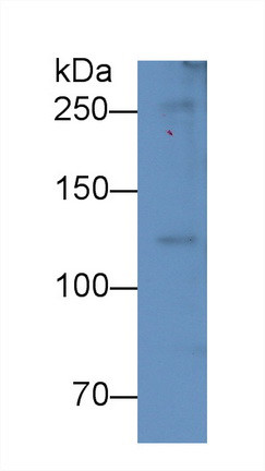 Complement C5a Antibody in Western Blot (WB)