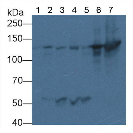 Nephrin Antibody in Western Blot (WB)