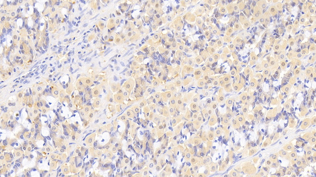 MMP7 Antibody in Immunohistochemistry (Paraffin) (IHC (P))