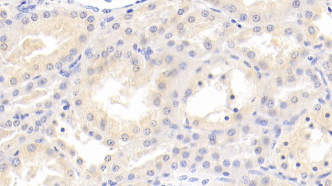 MMP7 Antibody in Immunohistochemistry (Paraffin) (IHC (P))