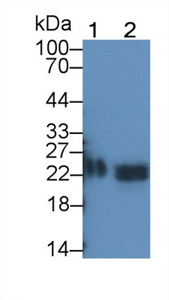 TIMP1 Antibody in Western Blot (WB)