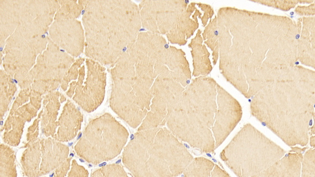 alpha-Cardiac Actin Antibody in Immunohistochemistry (Paraffin) (IHC (P))