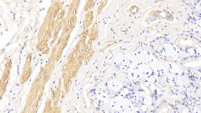 alpha-Cardiac Actin Antibody in Immunohistochemistry (Paraffin) (IHC (P))