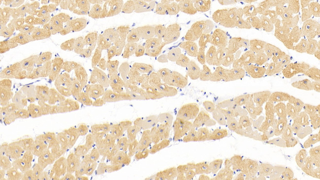 alpha-Cardiac Actin Antibody in Immunohistochemistry (Paraffin) (IHC (P))