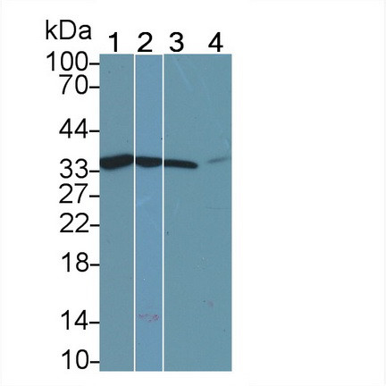 Calponin 2 Antibody in Western Blot (WB)