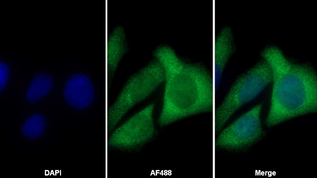 Cofilin Antibody in Immunocytochemistry (ICC/IF)