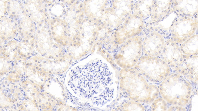 alpha-1 Antitrypsin Antibody in Immunohistochemistry (Paraffin) (IHC (P))