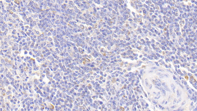 alpha-1 Antitrypsin Antibody in Immunohistochemistry (Paraffin) (IHC (P))