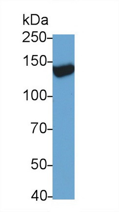 TRPM4 Antibody in Western Blot (WB)