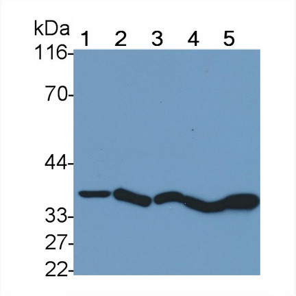 Cathepsin B Antibody in Western Blot (WB)