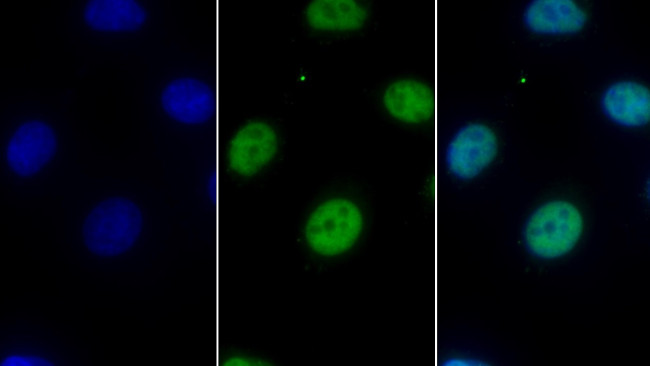 HDAC1 Antibody in Immunocytochemistry (ICC/IF)