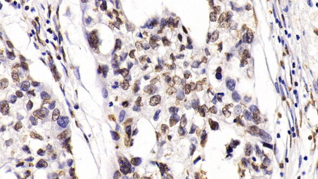 HDAC1 Antibody in Immunohistochemistry (Paraffin) (IHC (P))