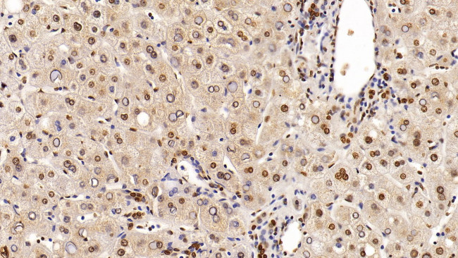 HDAC1 Antibody in Immunohistochemistry (Paraffin) (IHC (P))