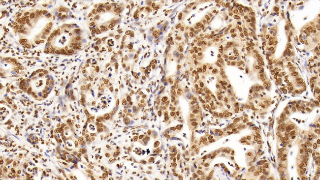 HDAC1 Antibody in Immunohistochemistry (Paraffin) (IHC (P))