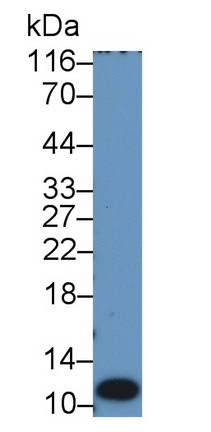 S100A12 Antibody in Western Blot (WB)