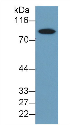 TAT complex Antibody in Western Blot (WB)