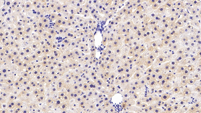 COMT Antibody in Immunohistochemistry (Paraffin) (IHC (P))