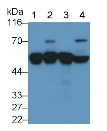 alpha-1 Antitrypsin Antibody in Western Blot (WB)