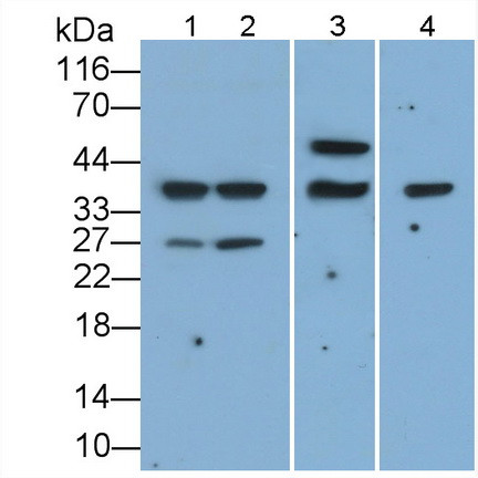CD79b Antibody in Western Blot (WB)