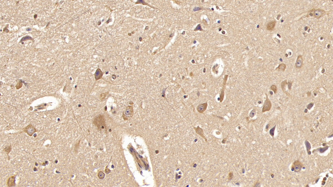 ACVR2A Antibody in Immunohistochemistry (Paraffin) (IHC (P))