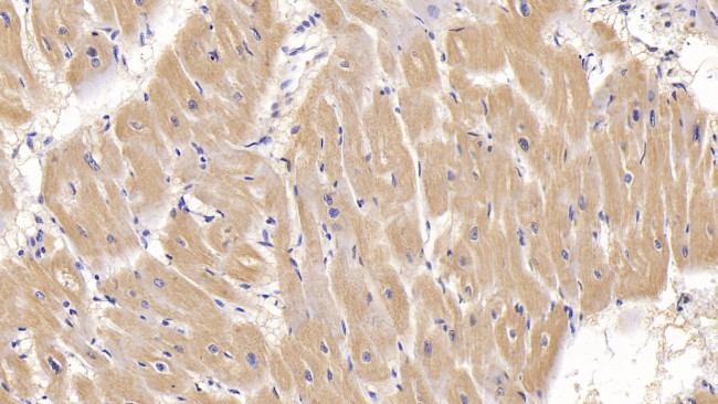 ACVR2A Antibody in Immunohistochemistry (Paraffin) (IHC (P))