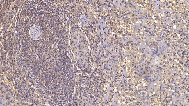 ACVR2A Antibody in Immunohistochemistry (Paraffin) (IHC (P))