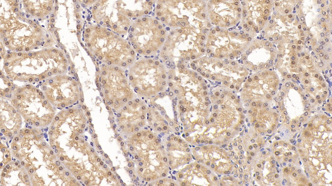 ACVR2A Antibody in Immunohistochemistry (Paraffin) (IHC (P))