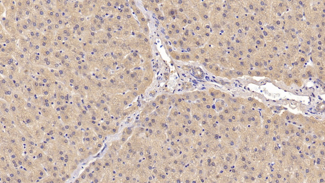 ACVR2A Antibody in Immunohistochemistry (Paraffin) (IHC (P))