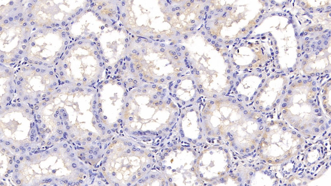 SHH Antibody in Immunohistochemistry (Paraffin) (IHC (P))