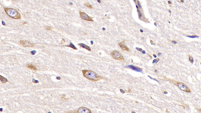 SHH Antibody in Immunohistochemistry (Paraffin) (IHC (P))