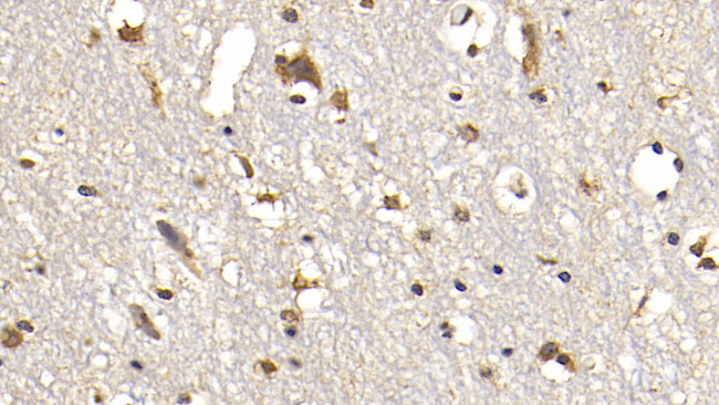 FAP Antibody in Immunohistochemistry (Paraffin) (IHC (P))