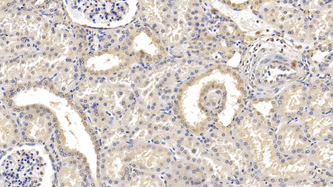 FAP Antibody in Immunohistochemistry (Paraffin) (IHC (P))