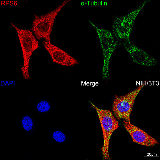 S6 Antibody in Immunocytochemistry (ICC/IF)