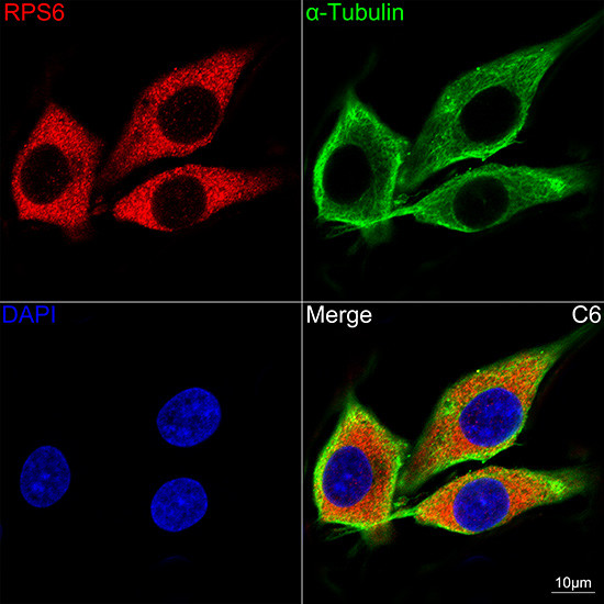 S6 Antibody in Immunocytochemistry (ICC/IF)