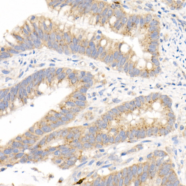 MMP3 Antibody in Immunohistochemistry (Paraffin) (IHC (P))