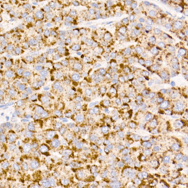 MMP3 Antibody in Immunohistochemistry (Paraffin) (IHC (P))