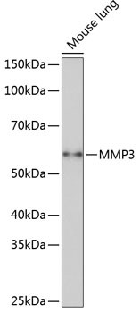 MMP3 Antibody in Western Blot (WB)