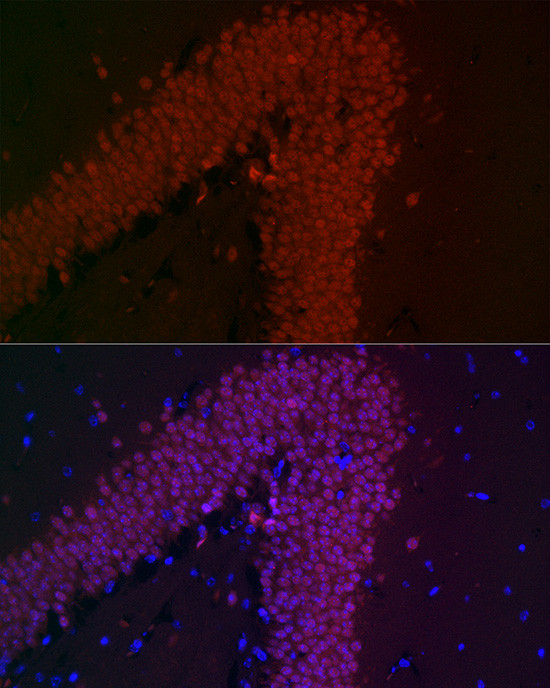 NeuN Antibody in Immunohistochemistry (Paraffin) (IHC (P))